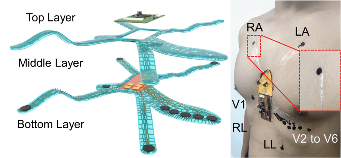 20230303-电子皮肤新闻稿-任天令课题组-图4 基于OSHIs构建表皮12导联心电监护系统.jpg